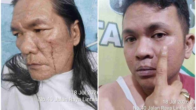Dugaan Penganiayaan oleh Oknum Panitera PN Pematangsiantar di Sinaksak, Korban Lapor Polisi